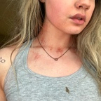 sydney_spiderz (Sydney Spiderz) free OnlyFans Leaked Videos and Pictures 

 profile picture